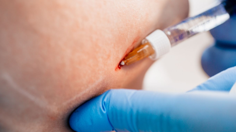 Cosmetic Injectables Course: Master Injections Safely