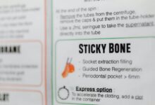 guide to oforektomerad explained