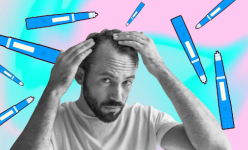 The Real Cost and Access Tradeoffs Behind GLP 1 Hair Loss