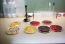 Rimmed or Smooth? How to Choose a Petri Dish for Automated Plating