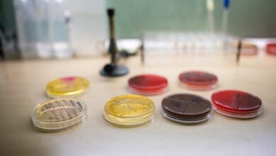 Rimmed or Smooth? How to Choose a Petri Dish for Automated Plating