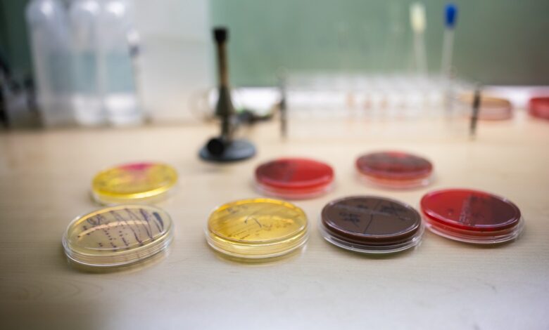 Rimmed or Smooth? How to Choose a Petri Dish for Automated Plating